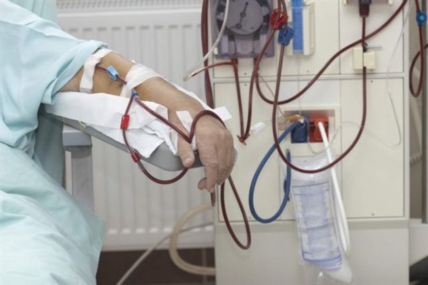 Σε δεινή οικονομική θέση οι Έλληνες νεφροπαθείς απομακρυσμένων αγροτικών  περιοχών από τη μη καταβολή των προβλεπομένων δαπανών για τη μετακίνησή τους 